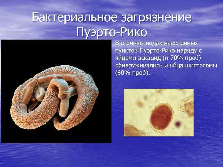 Бактериальное загрязнение Пуэрто-Рико В сточных водах населенных пунктов Пуэрто-Рико наряду с яйцами аскарид (в