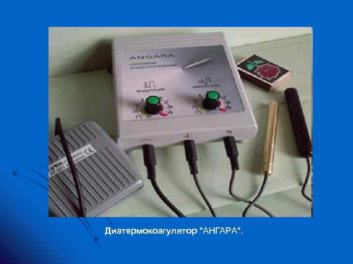 Диатермокоагулятор "АНГАРА". 