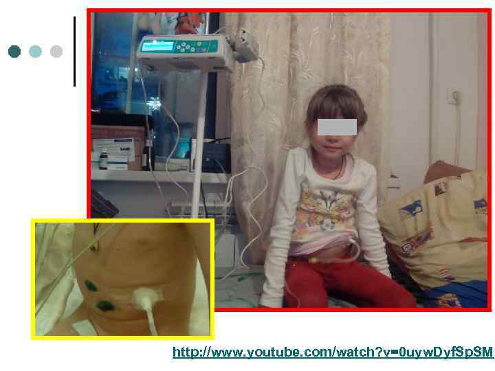 http: //www. youtube. com/watch? v=0 uyw. Dyf. Sp. SM 