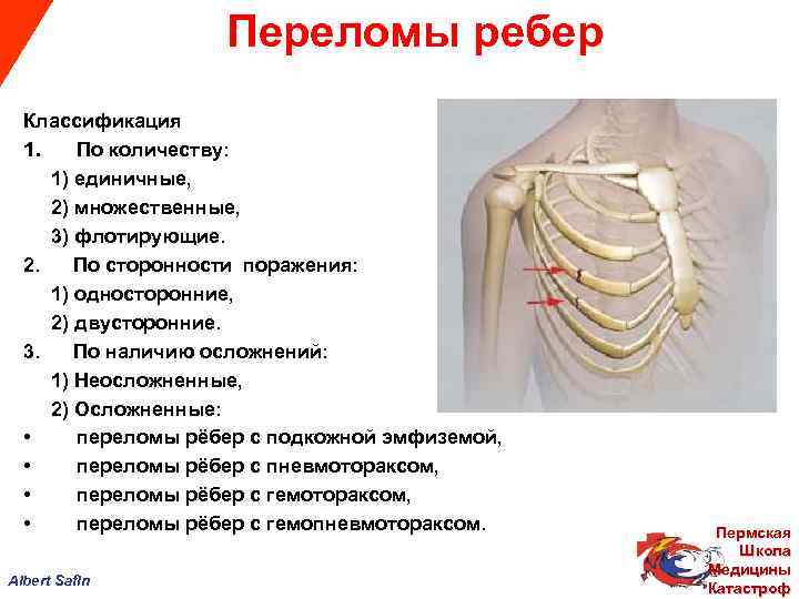  Переломы ребер Классификация 1. По количеству: 1) единичные, 2) множественные, 3) флотирующие. 2.