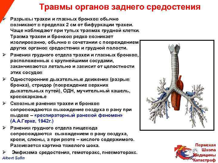  Травмы органов заднего средостения Ø Разрывы трахеи и главных бронхов обычно возникают в