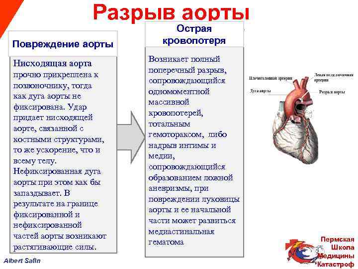  Разрыв аорты Острая Повреждение аорты кровопотеря Нисходящая аорта Возникает полный поперечный разрыв, прочно