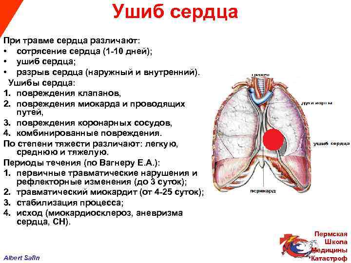  Ушиб сердца При травме сердца различают: • сотрясение сердца (1 -10 дней); •