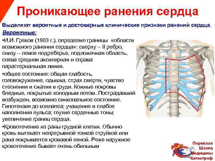  Проникающее ранения сердца Выделяют вероятные и достоверные клинические признаки ранений сердца. Вероятные: •