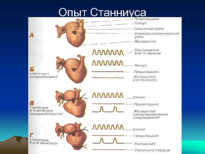 Схема наложения лигатур