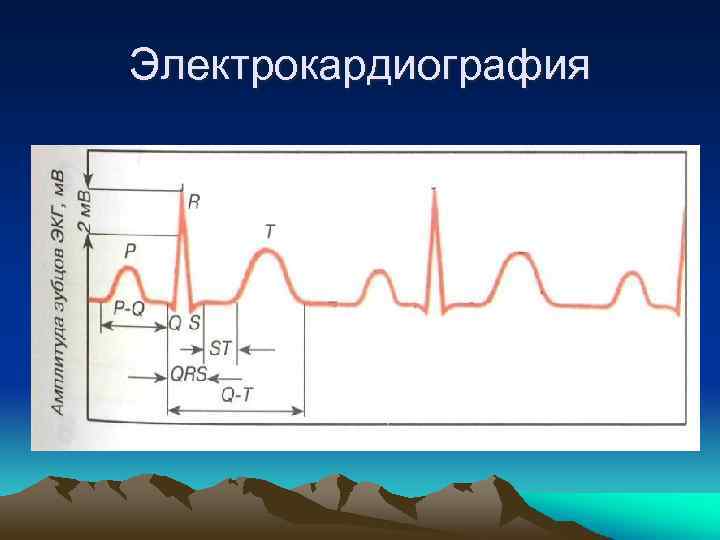 Электрокардиография 