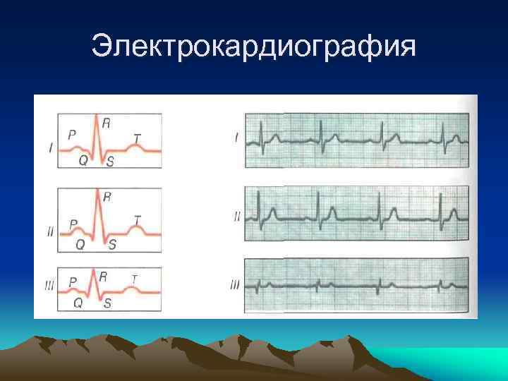 Электрокардиография 