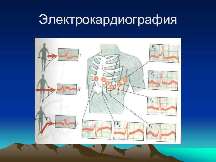 Электрокардиография 