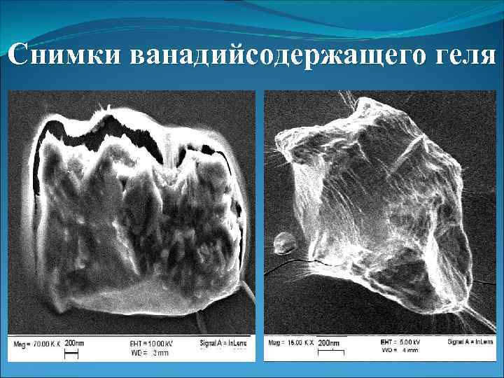 Снимки ванадийсодержащего геля 