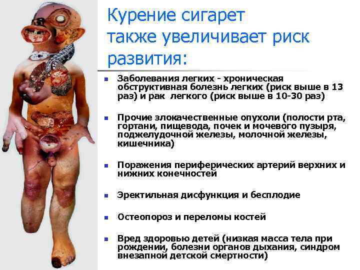 Курение сигарет также увеличивает риск развития: n n Заболевания легких - хроническая обструктивная болезнь