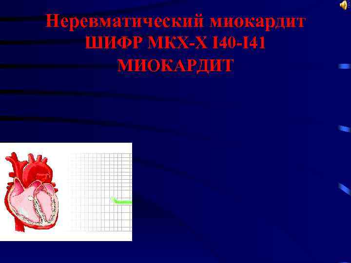 Неревматический миокардит ШИФР МКХ-Х I 40 -I 41 МИОКАРДИТ 