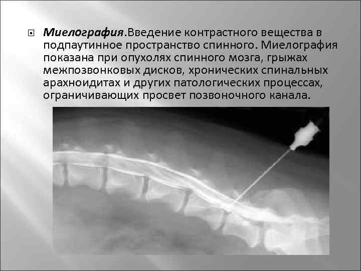 Big smol контраст мес. стоп контраст. стоп контраст. стоп контраст. креативные картинки для рекламы.