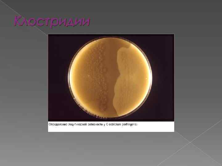 Клостридии 
