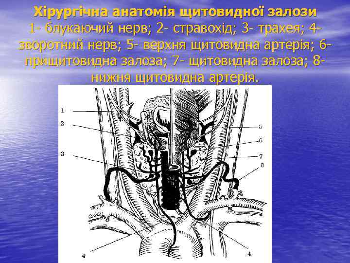 Хірургічна анатомія щитовидної залози 1 - блукаючий нерв; 2 - стравохід; 3 - трахея;