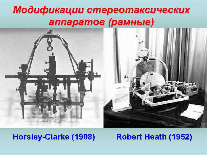 Модификации стереотаксических аппаратов (рамные) Horsley-Clarke (1908) Robert Heath (1952) 