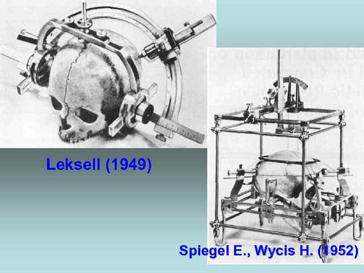 Leksell (1949) Spiegel E. , Wycis H. (1952) 