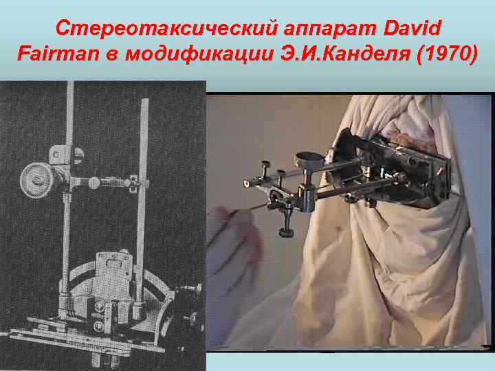 Стереотаксический аппарат David Fairman в модификации Э. И. Канделя (1970) 