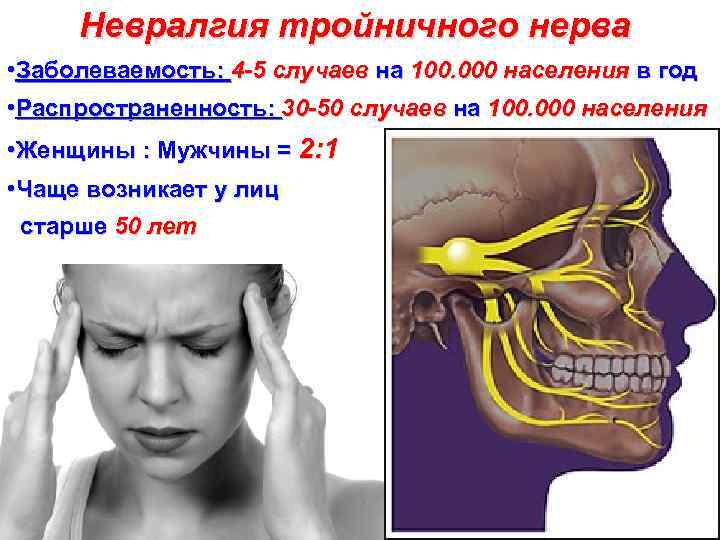 Невралгия тройничного нерва • Заболеваемость: 4 -5 случаев на 100. 000 населения в год