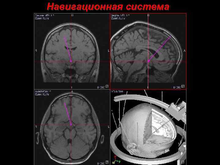 Навигационная система 