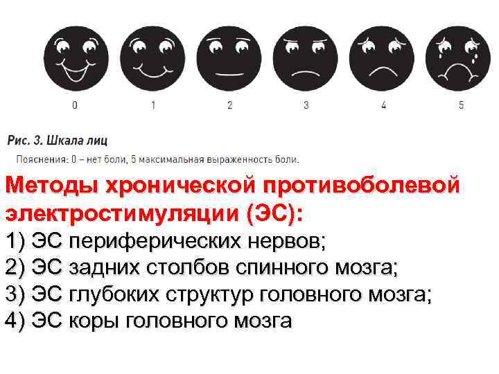 Методы хронической противоболевой электростимуляции (ЭС): 1) ЭС периферических нервов; 2) ЭС задних столбов спинного