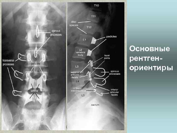 Основные рентгенориентиры 