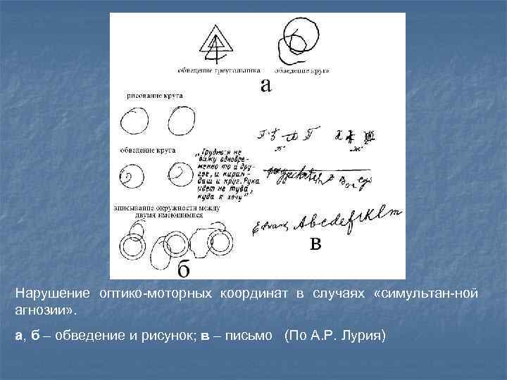 Нарушение оптико-моторных координат в случаях «симультан-ной агнозии» . а, б – обведение и рисунок;