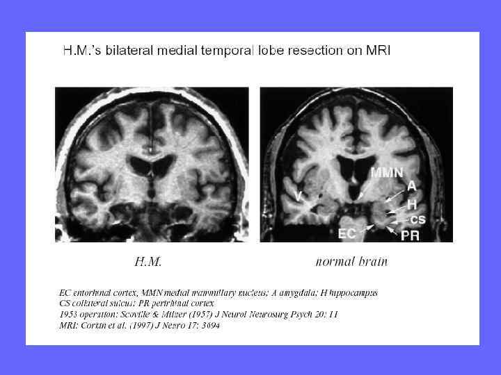 Сравнительная эффективность частичных отсчетов  при использовании кружка и полоски в  качестве 