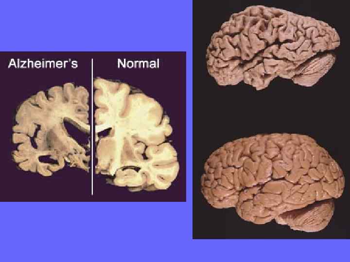 Холинергическая иннервация коры больших полушарий и гиппокампа нейронами    ядер септума и