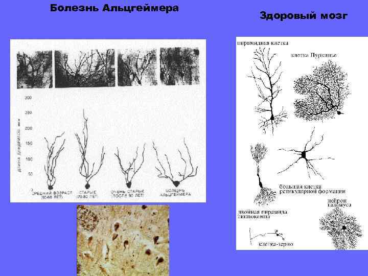 Молекулярный каскад  памяти. Кривые схематически показывают последовательность молекулярных изменений, наблюдаемых в гиперстриатуме цыпленка
