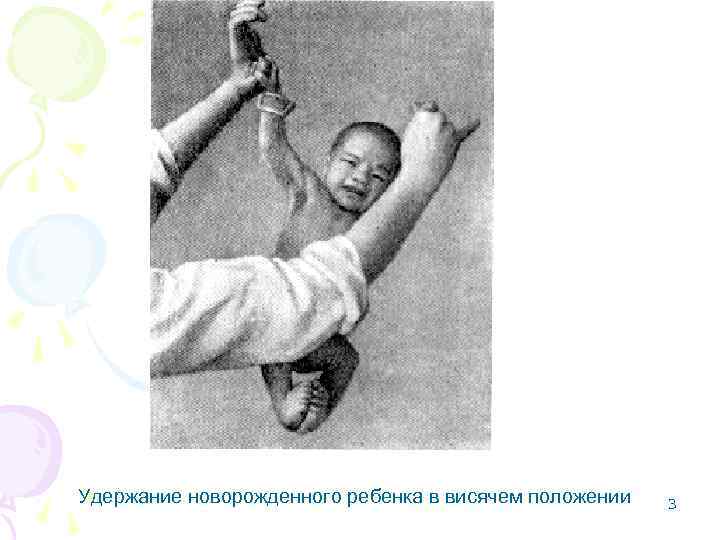 Удержание новорожденного ребенка в висячем положении 3 