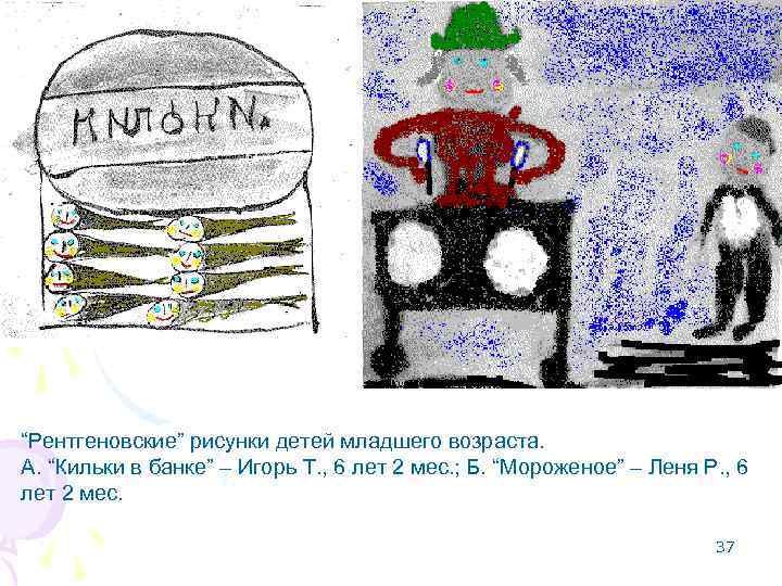 Стадии детского рисунка