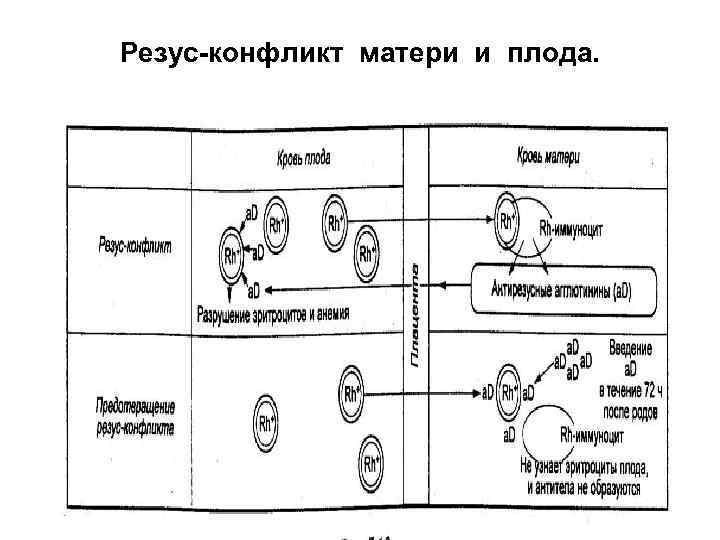 Резус-конфликт матери и плода. 
