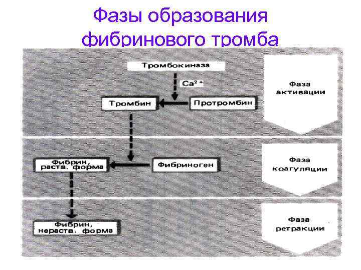 Фазы образования фибринового тромба 