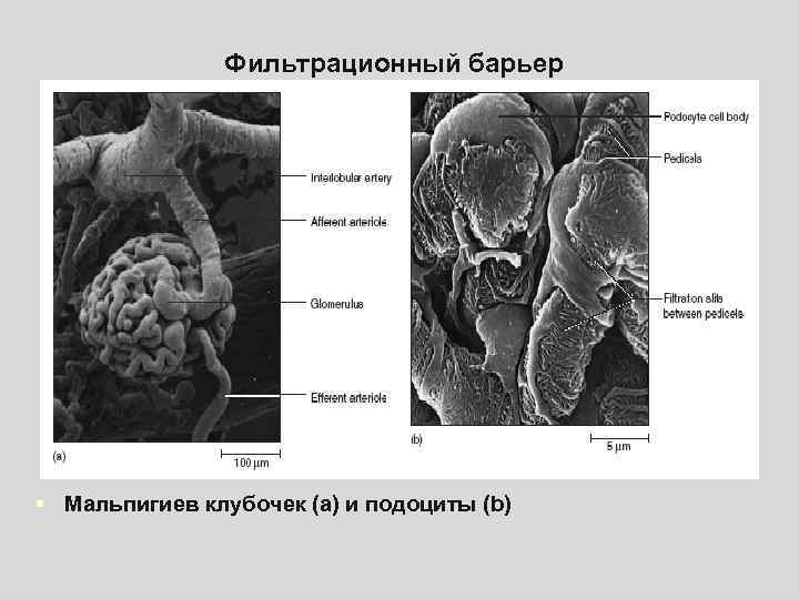 Фильтрационный барьер § Мальпигиев клубочек (а) и подоциты (b) 