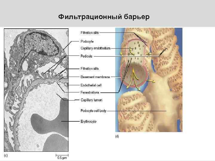 Фильтрационный барьер 