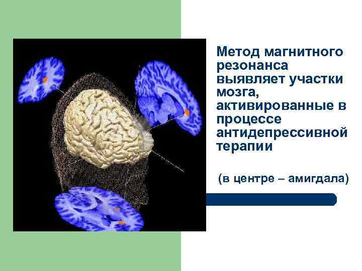 Метод магнитного резонанса выявляет участки мозга, активированные в процессе антидепрессивной терапии (в центре –