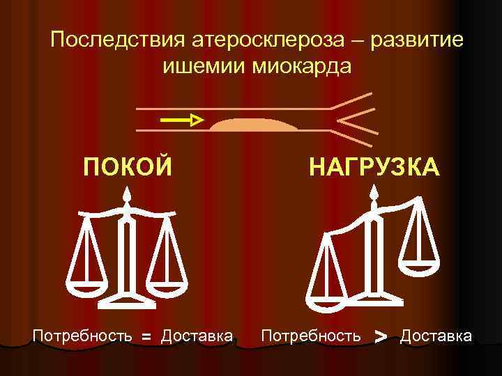 Последствия атеросклероза – развитие ишемии миокарда ПОКОЙ Потребность = Доставка НАГРУЗКА Потребность > Доставка