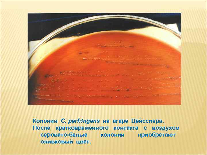 Колонии C. рerfringens на агаре Цейсслера. После кратковременного контакта с воздухом серовато-белые колонии приобретают