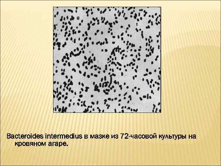 Bacteroides intermedius в мазке из 72 -часовой культуры на кровяном агаре. 