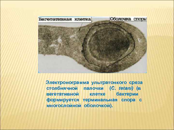 Электронограмма ультратонкого среза столбнячной палочки (C. tetani) (в вегетативной клетке бактерии формируется терминальная спора