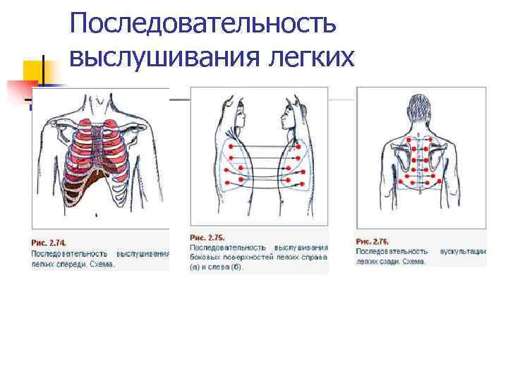 Последовательность выслушивания легких 