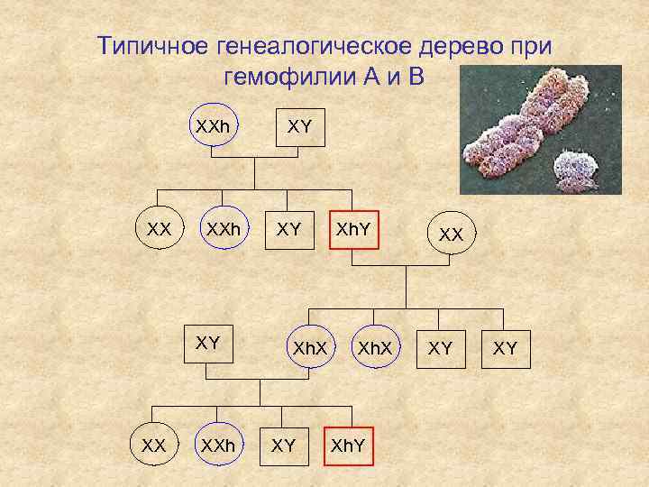 Типичное генеалогическое дерево при гемофилии А и В ХХh ХХ ХХh ХY ХY Хh.