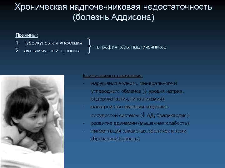 Хроническая надпочечниковая недостаточность (болезнь Аддисона) Причины: 1. туберкулезная инфекция атрофия коры надпочечников 2. аутоиммунный