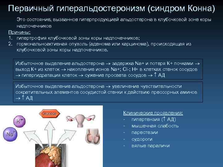 Первичный гиперальдостеронизм (синдром Конна) Это состояние, вызванное гиперпродукцией альдостерона в клубочковой зоне коры надпочечников