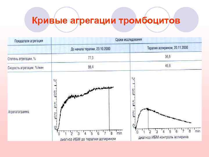 Кривые агрегации тромбоцитов 