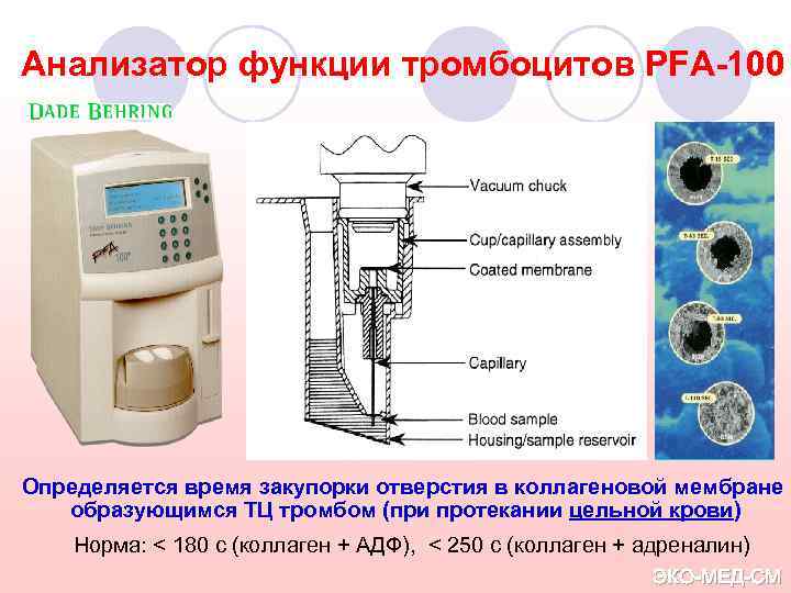 Анализатор функции тромбоцитов PFA-100 Определяется время закупорки отверстия в коллагеновой мембране образующимся ТЦ тромбом
