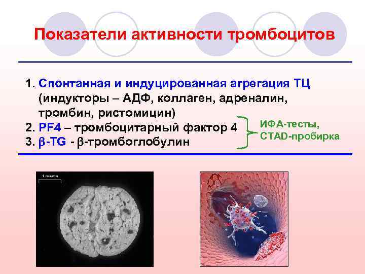 Система гемостаза картинки