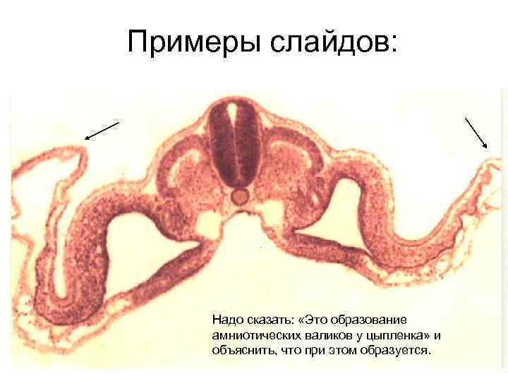 Примеры слайдов: Надо сказать: «Это образование амниотических валиков у цыпленка» и объяснить, что при