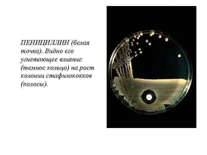 ПЕНИЦИЛЛИН (белая точка). Видно его угнетающее влияние (темное кольцо) на рост колонии стафилококков (полосы).