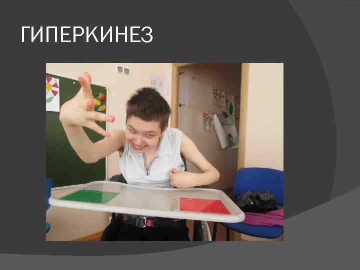 ГИПЕРКИНЕЗ 